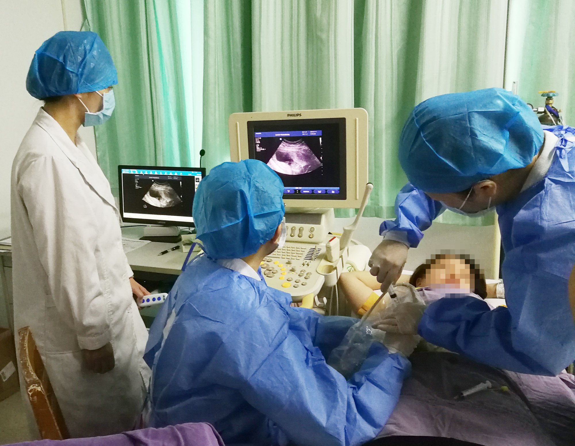 这次手术的成功,是桂北地区首例中孕期多胎妊娠选择性减胎术.